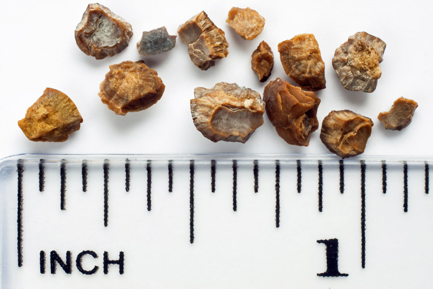 A bunch of small stones showing their size on a ruler. Most are around 1/8 inch.